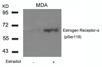 Western blot analysis of extracts from MDA cells untreated or treated with Estradiol using Estrogen Receptor-a(Phospho-Ser118) Antibody.Rabbit anti-Human ESR1 Polyclonal Antibody
