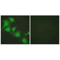 Immunofluorescence analysis of HuvEc cells, using NRF2 antibody.Rabbit anti-Human NFE2L2 Polyclonal Antibody