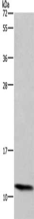 Gel: 10%SDS-PAGE, Lysate: 40 μg, Lane: HepG2 cells, Primary antibody: HSPE1 Antibody(HSPE1 Antibody) at dilution 1/750, Secondary antibody: Goat anti rabbit IgG at 1/8000 dilution, Exposure time: 5 minutesRabbit anti-Human HSPE1 Polyclonal Antibody