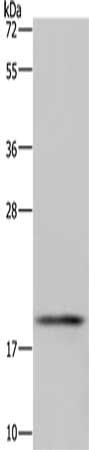 Gel: 10%SDS-PAGE, Lysate: 40 μg, Lane: 293T cells, Primary antibody: GLO1 Antibody(GLO1 Antibody) at dilution 1/350, Secondary antibody: Goat anti rabbit IgG at 1/8000 dilution, Exposure time: 10 secondsRabbit anti-Human GLO1 Polyclonal Antibody