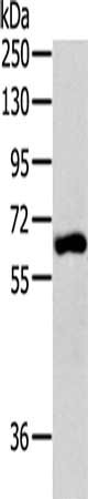 Gel: 8%SDS-PAGE, Lysate: 40 μg, Lane: SKOV3 cells, Primary antibody: BIRC2 Antibody(BIRC2 Antibody) at dilution 1/300, Secondary antibody: Goat anti rabbit IgG at 1/8000 dilution, Exposure time: 30 seconds
