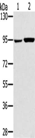 Gel: 6%SDS-PAGE, Lysate: 40 μg, Lane 1-2: 231 cells, PC3 cells, Primary antibody: PYGL Antibody(PYGL Antibody) at dilution 1/400, Secondary antibody: Goat anti rabbit IgG at 1/8000 dilution, Exposure time: 20 secondsRabbit anti-Human PYGL Polyclonal Antibody