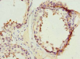 Immunohistochemistry of paraffin-embedded human testis tissue using PPP2R1B Antibody at dilution of 1:100Rabbit anti-Human PPP2R1B Polyclonal Antibody