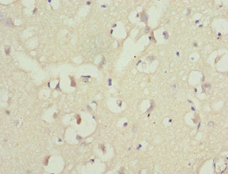 Immunohistochemistry of paraffin-embedded human brain tissue using PPP2R1B Antibody at dilution of 1:100Rabbit anti-Human PPP2R1B Polyclonal Antibody