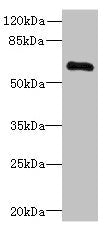 Western blot  | All lanes: PPP2R1B antibody at 3.33µg/ml + Jurkat whole cell lysate  | Secondary  | Goat polyclonal to rabbit IgG at 1/10000 dilution  | Predicted band size: 67, 74, 62, 53 kDa  | Observed band size: 67 kDaRabbit anti-Human PPP2R1B Polyclonal Antibody