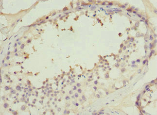 Immunohistochemistry of paraffin-embedded human testis tissue using the antibody at dilution of 1:100Rabbit anti-Human PPP2R1B Polyclonal Antibody