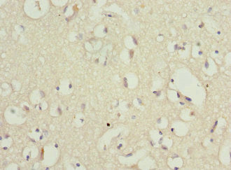 Immunohistochemistry of paraffin-embedded human brain tissue using PPP2R1B Antibody at dilution of 1:100Rabbit anti-Human PPP2R1B Polyclonal Antibody