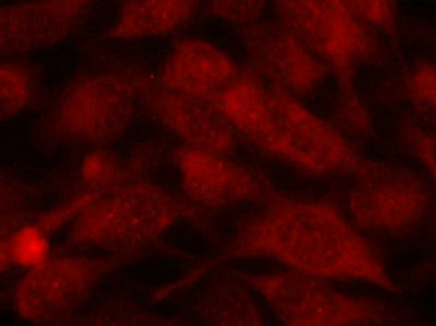 Immunofluorescence staining of methanol-fixed Hela cells using Stathmin 1(Ab-38) Antibody.Rabbit anti-Human STMN1 Polyclonal Antibody