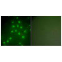 Immunofluorescence analysis of HepG2 cells, using HDAC9 antibody.Rabbit anti-Human HDAC9 Polyclonal Antibody