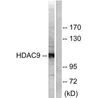 Western blot analysis of extracts from HepG2 cells, using HDAC9 antibody.Rabbit anti-Human HDAC9 Polyclonal Antibody