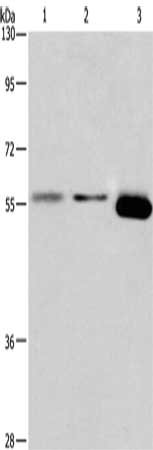 Gel: 6%SDS-PAGE, Lysate: 40 μg, Lane 1-3: A549 cells, RAW264.7 cells, mouse brain tissue, Primary antibody: ARRB1 Antibody(ARRB1 Antibody) at dilution 1/100, Secondary antibody: Goat anti rabbit IgG at 1/8000 dilution, Exposure time: 5 minutesRabbit anti-Human ARRB1 Polyclonal Antibody