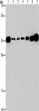 Gel: 15%SDS-PAGE, Lysate: 40 μg, Lane 1-7: Lovo cells, A431 cells, A549 cells, hela cells, hepG2 cells, Raji cells, mouse brain tissue, Primary antibody: CRKL Antibody(CRKL Antibody) at dilution 1/550, Secondary antibody: Goat anti rabbit IgG at 1/8000 dilution, Exposure time: 1 minuteRabbit anti-Human CRKL Polyclonal Antibody