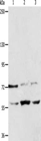 Gel: 8%SDS-PAGE, Lysate: 40 μg, Lane 1-3: Lovo cells, hela cells, 293T cells, Primary antibody: SYVN1 Antibody(SYVN1 Antibody) at dilution 1/100, Secondary antibody: Goat anti rabbit IgG at 1/8000 dilution, Exposure time: 1 minuteRabbit anti-Human SYVN1 Polyclonal Antibody