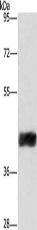 Gel: 8%SDS-PAGE, Lysate: 40 μg, Lane: Human fetal liver tissue, Primary antibody: CRELD2 Antibody(CRELD2 Antibody) at dilution 1/421, Secondary antibody: Goat anti rabbit IgG at 1/8000 dilution, Exposure time: 2 minutesRabbit anti-Human CRELD2 Polyclonal Antibody