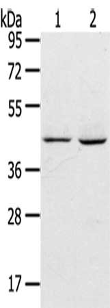 Gel: 8%SDS-PAGE,Lysate: 40 μg,Lane 1-2: HepG2 cells, Hela cells,Primary antibody: ADRB3 Antibody(ADRB3 Antibody) at dilution 1/200 dilution,Secondary antibody: Goat anti rabbit IgG at 1/8000 dilution,Exposure time: 20 secondsRabbit anti-Human ADRB3 Polyclonal Antibody