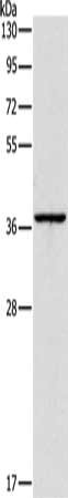 Gel: 10%SDS-PAGE, Lysate: 40 μg, Lane: Huvec cells, Primary antibody: APOL2 Antibody(APOL2 Antibody) at dilution 1/375, Secondary antibody: Goat anti rabbit IgG at 1/8000 dilution, Exposure time: 40 secondsRabbit anti-Human APOL2 Polyclonal Antibody