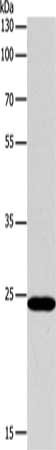 Gel: 10%SDS-PAGE, Lysate: 40 μg, Lane: Hela cells, Primary antibody: BCL2 Antibody(BCL2 Antibody) at dilution 1/650, Secondary antibody: Goat anti rabbit IgG at 1/8000 dilution, Exposure time: 30 seconds