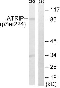 Western blot analysis of extracts from 292 cells, treated with UV (15mins), using ATRIP (Phospho-Ser224) antibody. The lane on the right is treated with the synthesized peptide.