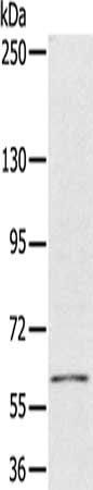 Gel: 6%SDS-PAGE, Lysate: 40 μg, Lane: Human bladder carcinoma tissue, Primary antibody: PDP1 Antibody(PDP1 Antibody) at dilution 1/300, Secondary antibody: Goat anti rabbit IgG at 1/8000 dilution, Exposure time: 40 secondsRabbit anti-Human PDP1 Polyclonal Antibody
