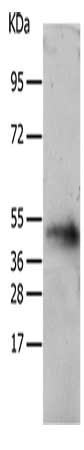 Gel: 10%SDS-PAGE, Lysate: 40 μg, Lane: Human liver cancer tissue, Primary antibody: TACR2 Antibody(TACR2 Antibody) at dilution 1/200, Secondary antibody: Goat anti rabbit IgG at 1/8000 dilution, Exposure time: 2 minutesRabbit anti-Human TACR2 Polyclonal Antibody
