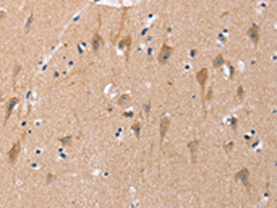 The image on the left is immunohistochemistry of paraffin-embedded Human brain  tissue using OTUB1 Antibody(OTUB1 Antibody) at dilution 1/40, on the right is treated with fusion protein. (Original magnification: ×200)Rabbit anti-Human OTUB1 Polyclonal Antibody
