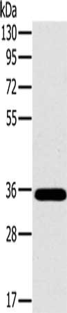 Gel: 8%SDS-PAGE, Lysate: 40 μg, Lane: Mouse brain tissue, Primary antibody: OTUB1 Antibody(OTUB1 Antibody) at dilution 1/800, Secondary antibody: Goat anti rabbit IgG at 1/8000 dilution, Exposure time: 20 secondsRabbit anti-Human OTUB1 Polyclonal Antibody