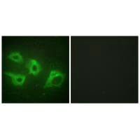 Immunofluorescence analysis of HeLa cells, using CKI-α antibody.Rabbit anti-Human CSNK1A1 Polyclonal Antibody