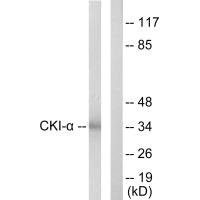 Western blot analysis of extracts from HeLa cells, using CKI-α antibody.Rabbit anti-Human CSNK1A1 Polyclonal Antibody