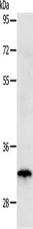 Gel: 12%SDS-PAGE, Lysate: 40 μg, Lane: Huvec cells, Primary antibody: TIMP3 Antibody(TIMP3 Antibody) at dilution 1/250, Secondary antibody: Goat anti rabbit IgG at 1/8000 dilution, Exposure time: 10 secondsRabbit anti-Human TIMP3 Polyclonal Antibody