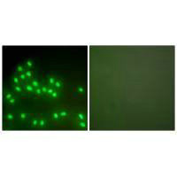 Immunofluorescence analysis of A549 cells, using Ku70/80 antibody.Rabbit anti-Human XRCC6/XRCC5 Polyclonal Antibody