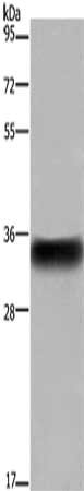 Gel: 8%SDS-PAGE, Lysate: 40 μg, Lane: Human placenta tissue, Primary antibody: FCGR2B Antibody(FCGR2B Antibody) at dilution 1/850, Secondary antibody: Goat anti rabbit IgG at 1/8000 dilution, Exposure time: 5 secondsRabbit anti-Human FCGR2B Polyclonal Antibody