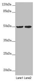 Western blot  | All lanes: SLC39A7 antibody at 4.06µg/ml  | Lane 1: MCF-7 whole cell lysate  | Lane 2: HepG2 whole cell lysate  | Secondary  | Goat polyclonal to rabbit IgG at 1/10000 dilution  | Predicted band size: 51 kDa  | Observed band size: 51 kDaRabbit anti-Human SLC39A7 Polyclonal Antibody