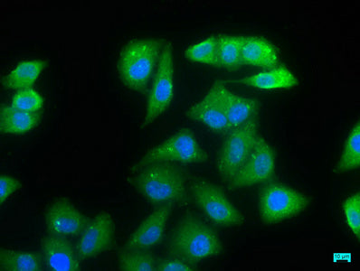 Immunofluorescence staining of Hela cells with NDRG1 Antibody at 1:66, counter-stained with DAPI. The cells were fixed in 4% formaldehyde, permeabilized using 0.2% Triton X-100 and blocked in 10% normal Goat Serum. The cells were then incubated with the antibody overnight at 4°C. The secondary antibody was Alexa Fluor 488-congugated AffiniPure Goat Anti-Rabbit IgG(H+L).Rabbit anti-Human NDRG1 Polyclonal Antibody