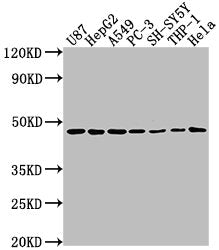 Western Blot | Positive WB detected in: U87 whole cell lysate, HepG2 whole cell lysate, A549 whole cell lysate, PC-3 whole cell lysate, SH-SY5Y whole cell lysate, THP-1 whole cell lysate, Hela whole cell lysate | All lanes: NDRG1 antibody at 1:2000 | Secondary | Goat polyclonal to rabbit IgG at 1/50000 dilution | Predicted band size: 43, 36, 34 kDa | Observed band size: 43 kDaRabbit anti-Human NDRG1 Polyclonal Antibody