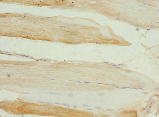 Immunohistochemistry of paraffin-embedded human skeletal muscle tissue using SGCD Antibody at dilution of 1:100Rabbit anti-Human SGCD Polyclonal Antibody