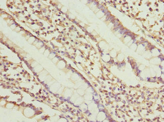 Immunohistochemistry of paraffin-embedded human small intestine tissue using SGCD Antibody at dilution of 1:100Rabbit anti-Human SGCD Polyclonal Antibody