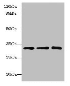 Western blot  | All lanes: RRAS2 antibody at 4.55µg/ml  | Lane 1: Mouse kidney tissue  | Lane 2: Mouse liver tissue  | Lane 3: Jurkat whole cell lysate  | Secondary  | Goat polyclonal to rabbit IgG at 1/10000 dilution  | Predicted band size: 33, 29 kDa  | Observed band size: 33 kDaRabbit anti-Human SGCD Polyclonal Antibody