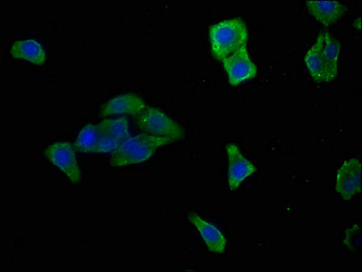 Immunofluorescence staining of HepG2 cells with HTRA1 Antibody at 1:166, counter-stained with DAPI. The cells were fixed in 4% formaldehyde, permeabilized using 0.2% Triton X-100 and blocked in 10% normal Goat Serum. The cells were then incubated with the antibody overnight at 4°C. The secondary antibody was Alexa Fluor 488-congugated AffiniPure Goat Anti-Rabbit IgG(H+L).Rabbit anti-Human HTRA1 Polyclonal Antibody