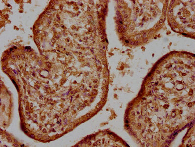 IHC image of the antibody diluted at 1:500 and staining in paraffin-embedded human kidney tissue performed on a Leica BondTM system. After dewaxing and hydration, antigen retrieval was mediated by high pressure in a citrate buffer (pH 6.0). Section was blocked with 10% normal goat serum 30min at RT. Then primary antibody (1% BSA) was incubated at 4°C overnight. The primary is detected by a biotinylated secondary antibody and visualized using an HRP conjugated SP system.Rabbit anti-Human HTRA1 Polyclonal Antibody