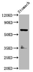Western Blot | Positive WB detected in: Rat stomach tissue | All lanes: SLC5A5 antibody at 3.7μg/ml | Secondary | Goat polyclonal to rabbit IgG at 1/50000 dilution | Predicted band size: 69 kDa | Observed band size: 69 kDaRabbit anti-Human SLC5A5 Polyclonal Antibody