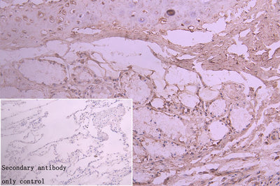 Immunohistochemistry of paraffin-embedded human lung tissue using TSR2 Antibody at dilution of 1:100Rabbit anti-Human TSR2 Polyclonal Antibody