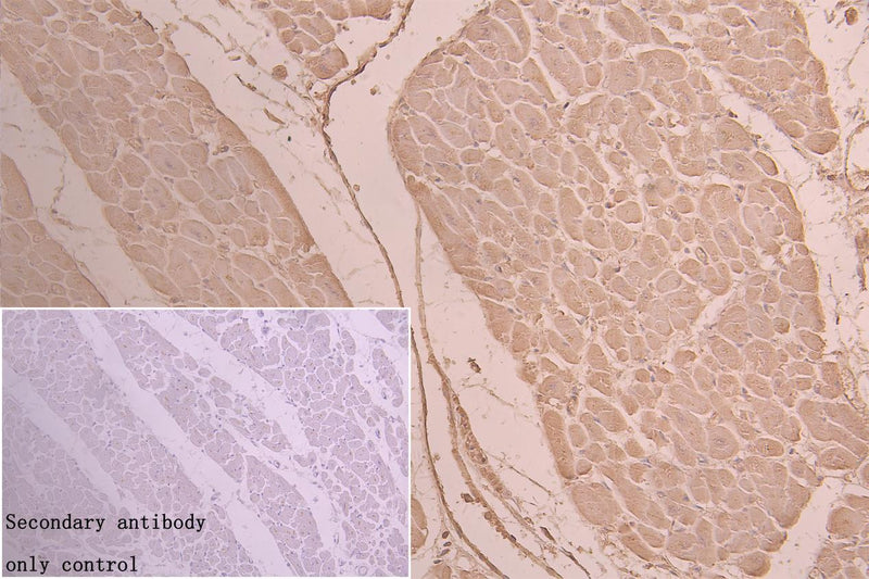 Immunohistochemistry of paraffin-embedded human heart tissue using TSR2 Antibody at dilution of 1:100Rabbit anti-Human TSR2 Polyclonal Antibody