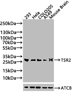 Western Blot  | Positive WB detected in: HEK293 whole cell lysate  | All lanes: TSR2 antibody at 2µg/ml  | Secondary  | Goat polyclonal to rabbit IgG at 1/50000 dilution  | Predicted band size: 21 kDa  | Observed band size: 21 kDaRabbit anti-Human TSR2 Polyclonal Antibody