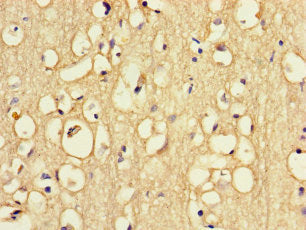 Immunohistochemistry of paraffin-embedded human brain tissue using RFK Antibody at dilution of 1:100Rabbit anti-Human RFK Polyclonal Antibody