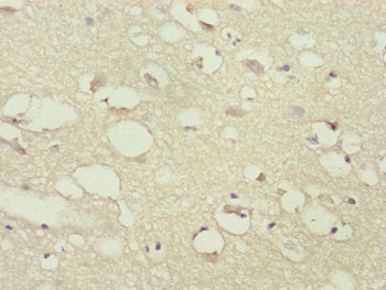 Immunohistochemistry of paraffin-embedded human brain tissue using PPP2R3C Antibody at dilution of 1:100Rabbit anti-Human PPP2R3C Polyclonal Antibody