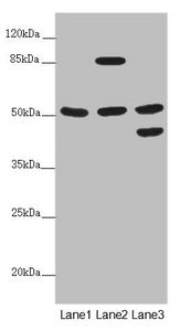 Western blot | All lanes: PPP2R3C antibody at 5.11 μg/ml | Lane 1: HepG2 whole cell lysate | Lane 2: Jurkat whole cell lysate | Lane 3: A549 whole cell lysate | Secondary | Goat polyclonal to rabbit IgG at 1/10000 dilution | Predicted band size: 54, 40 kDa | Observed band size: 54, 85, 45 kDaRabbit anti-Human PPP2R3C Polyclonal Antibody