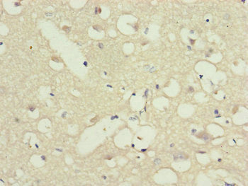 Immunohistochemistry of paraffin-embedded human brain tissue using PPP2R3C Antibody at dilution of 1:100Rabbit anti-Human PPP2R3C Polyclonal Antibody