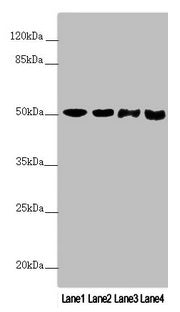 Western blot  | All lanes: PPP2R3C antibody at 3.76µg/ml  | Lane 1: Mouse stomach tissue  | Lane 2: A431 whole cell lysate  | Lane 3: Jurkat whole cell lysate  | Lane 4: A549 whole cell lysate  | Secondary  | Goat polyclonal to rabbit IgG at 1/10000 dilution  | Predicted band size: 54, 40 kDa  | Observed band size: 54 kDaRabbit anti-Human PPP2R3C Polyclonal Antibody