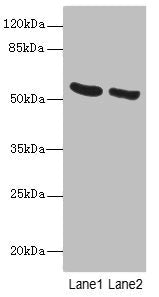 Western blot  | All lanes: PNPLA2 antibody at 10µg/ml  | Lane 1: Mouse liver tissue  | Lane 2: NIH/3T3 whole cell lysate  | Secondary  | Goat polyclonal to rabbit IgG at 1/10000 dilution  | Predicted band size: 56, 20 kDa  | Observed band size: 56 kDaRabbit anti-Human PNPLA2 Polyclonal Antibody