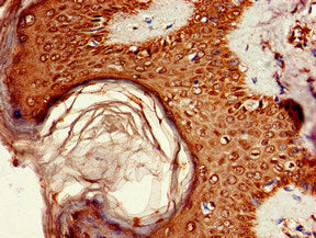 Immunohistochemistry of paraffin-embedded human skin tissue using the antibody at dilution of 1:100Rabbit anti-Human AKT1S1 Polyclonal Antibody